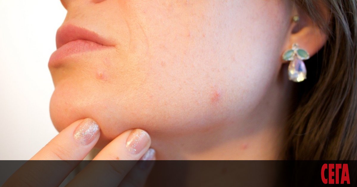 Слънце, плаж, море – лятото е дългоочаквано време за мнозина,