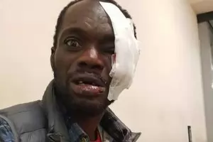 МВР се разсейва за пребит пред входа му британец