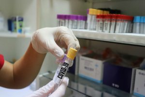 Търговията с тестове за коронавирус в частните лаборатории е в