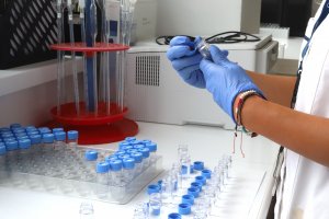 Резултатите от пробите на хората които са били в контакт