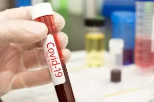 Коронавирусът влезе и в Агенцията по отбрана към ЕС 