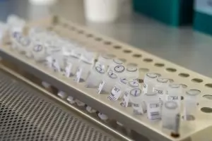 Австрия: върхът на епидемията се оказа по-висок