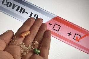 Излекуваните пациенти от COVID 19 които дават положителни проби не са