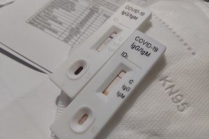 482 са новорегистрираните с коронавирус за последните 24 часа при