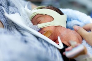 Родителите на недоносените деца трябва да имат достъп до тях