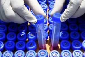 Регионалното правителство на Естремадура потвърди първият случай на заразен испанец