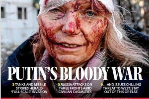 Сега ние виждаме Путин такъв какъвто е окървавен агресор