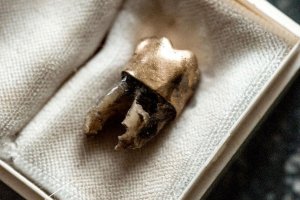 Пътешествието на зъба започва в Белгийско Конго през 30 те години