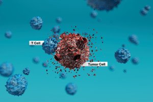 Пациенти в напреднал стадий на определен вид меланом рак на
