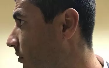 На снимката ясно се виждат белези по врата на спортния директор на "ЦСКА 1948" Кирил Котев, като той твърди, че има над 30 свидетели, че раната му е нанесена от Стойне Манолов.