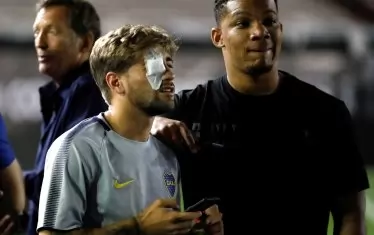 Гонсало Ламардо от "Бока" се върна на стадиона с превръзка на окото, докато все още принуждаваха тима му да играе.