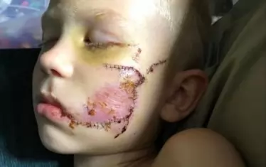  Бриджър има 90 шева на лицето. Е