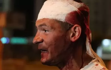 Ранен в главата демонстрант търси спешна помощ.