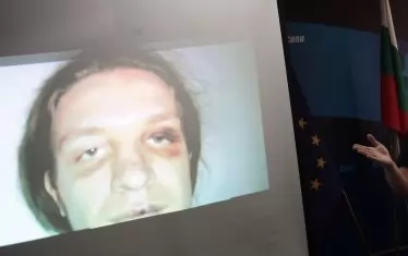 Пребит от полицаи осъди прокуратурата за незаконно обвинение