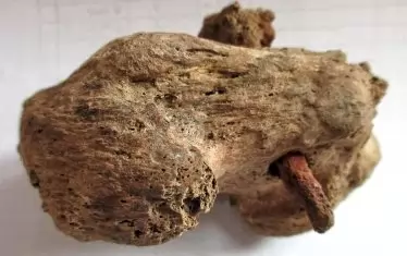  Петната кост (калканеус) със забития в нея пирон. 
