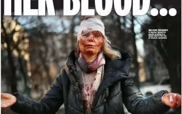  Западни издания отразяват войната