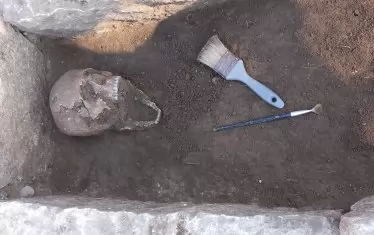  Разкритият череп на мъжа.