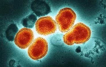 Грипът вече е официално в България след регистриран вирус A(H3N2)